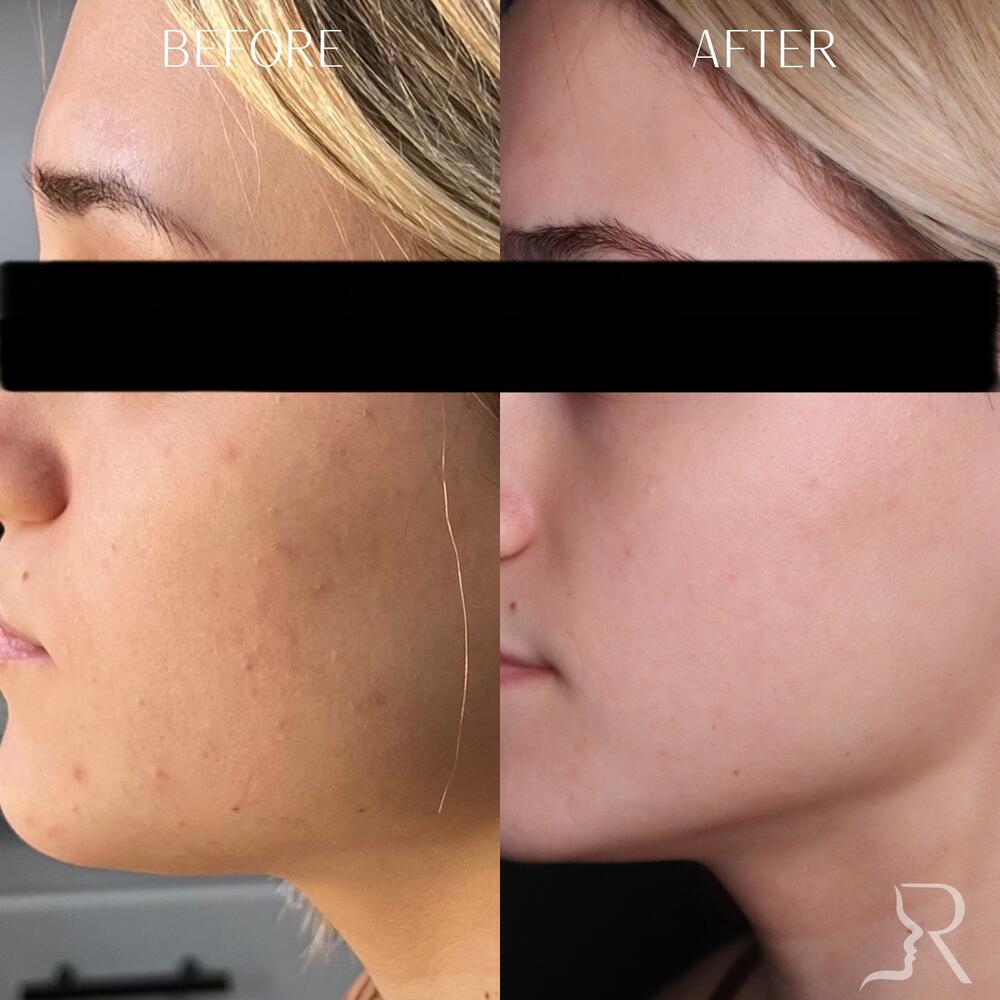 Medical-Grade Skincare Before & After Image