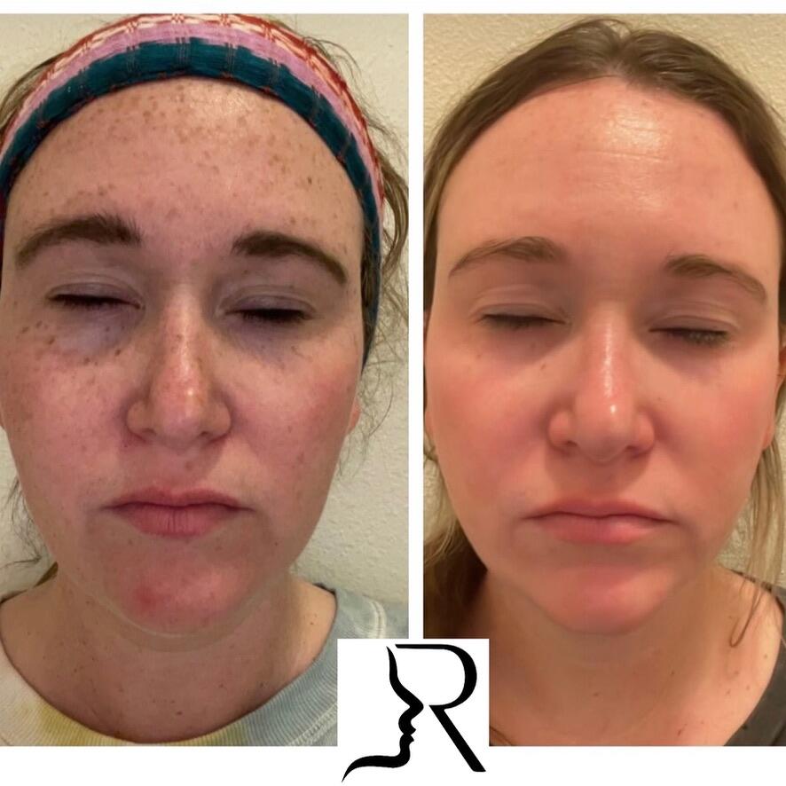 Medical-Grade Skincare Before & After Image