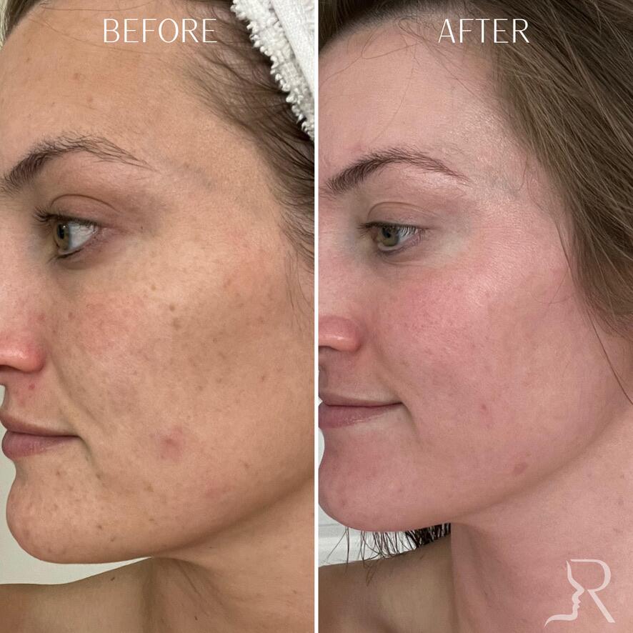 Medical-Grade Skincare Before & After Image