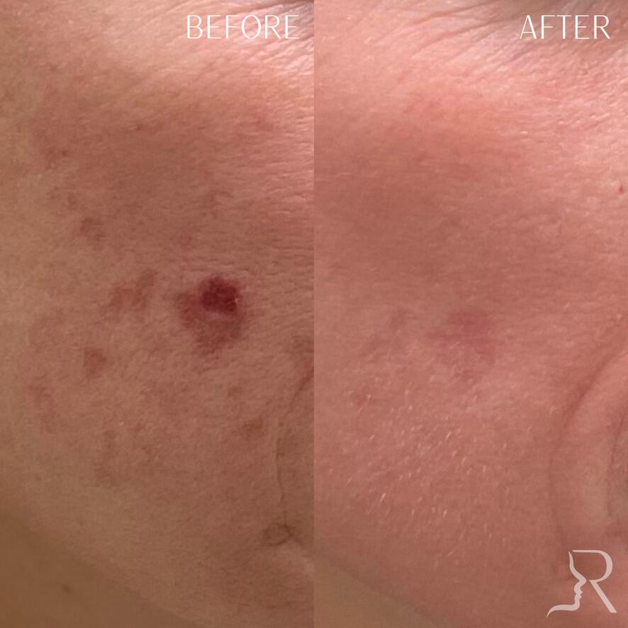 Medical-Grade Skincare Before & After Image