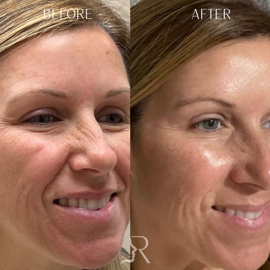 Medical-Grade Skincare Before & After Image