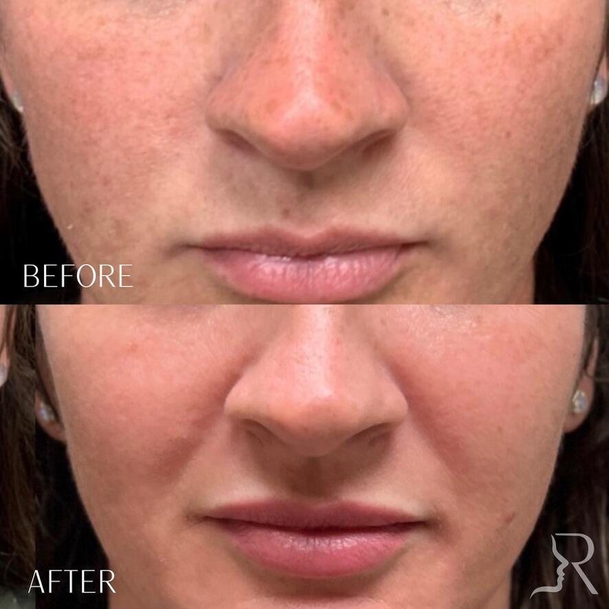 Medical-Grade Skincare Before & After Image