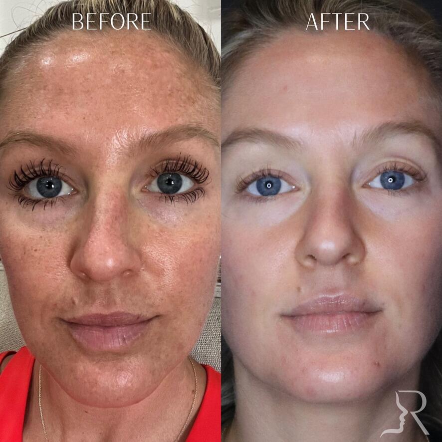 Medical-Grade Skincare Before & After Image