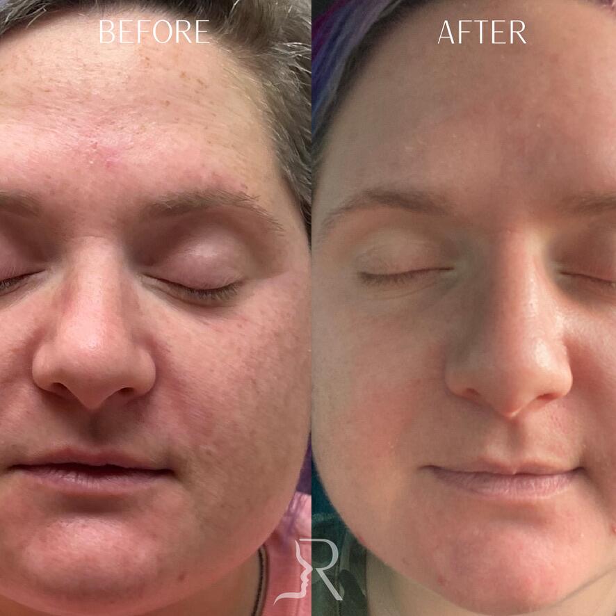 Medical-Grade Skincare Before & After Image