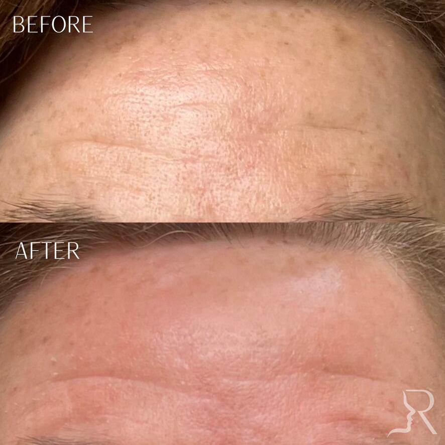 Medical-Grade Skincare Before & After Image