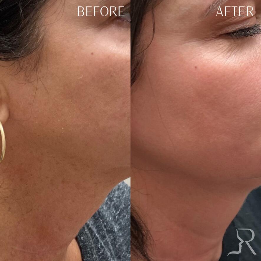 Medical-Grade Skincare Before & After Image