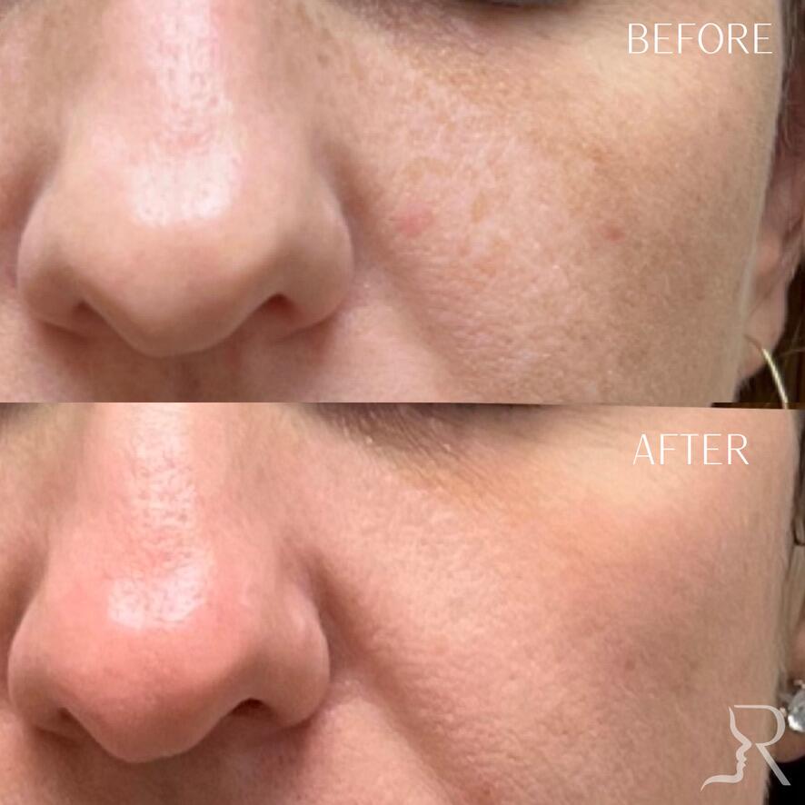 Medical-Grade Skincare Before & After Image