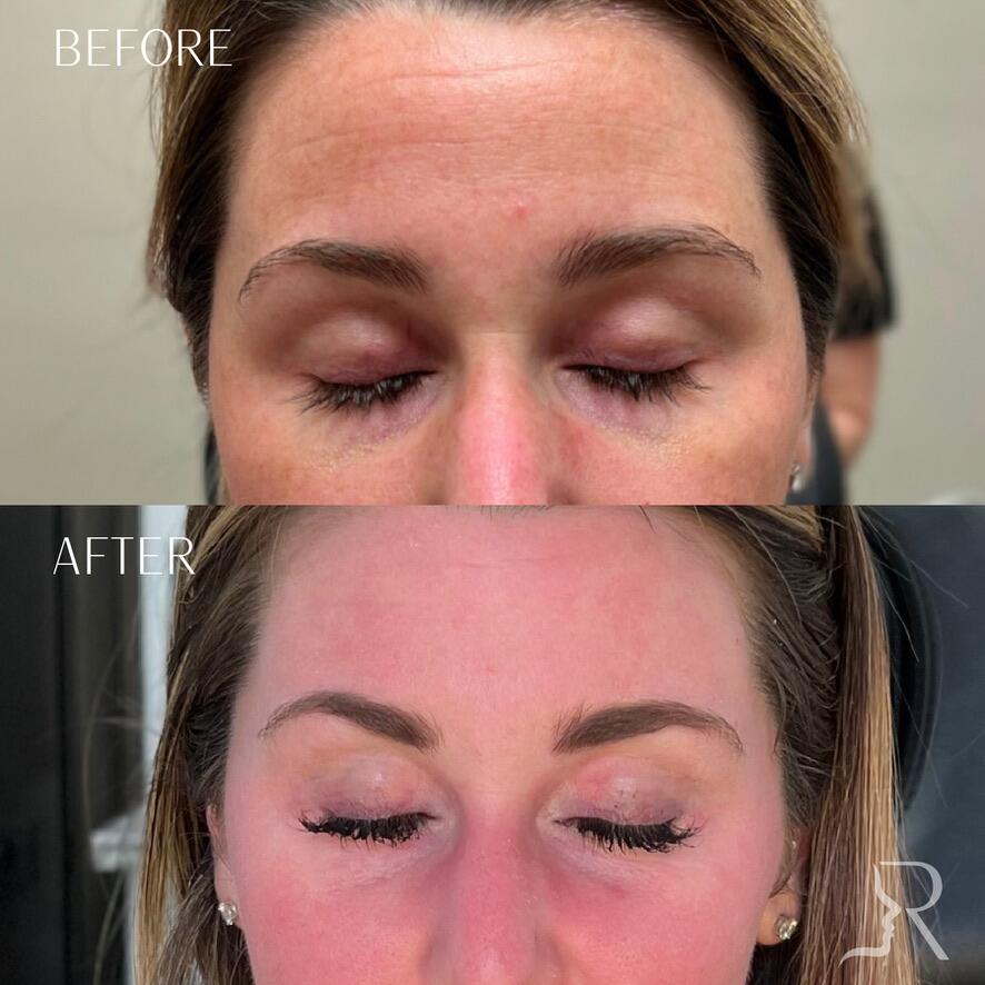 Medical-Grade Skincare Before & After Image