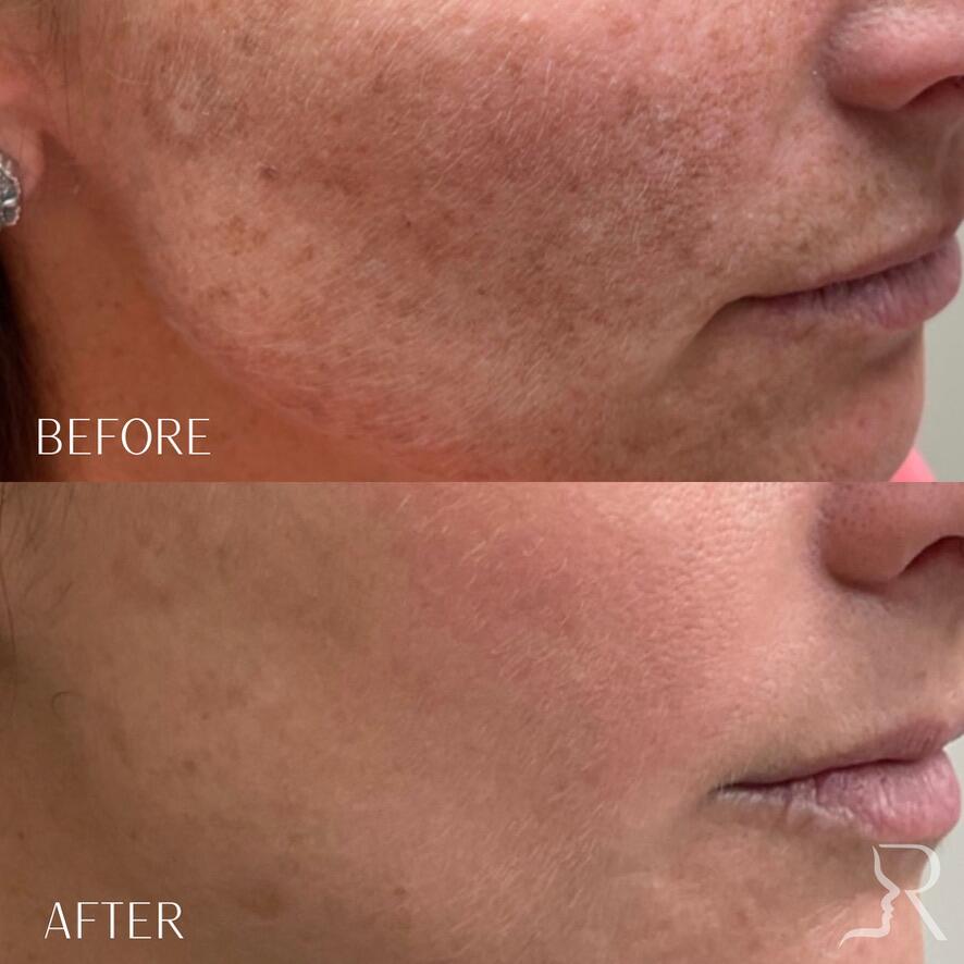 Medical-Grade Skincare Before & After Image