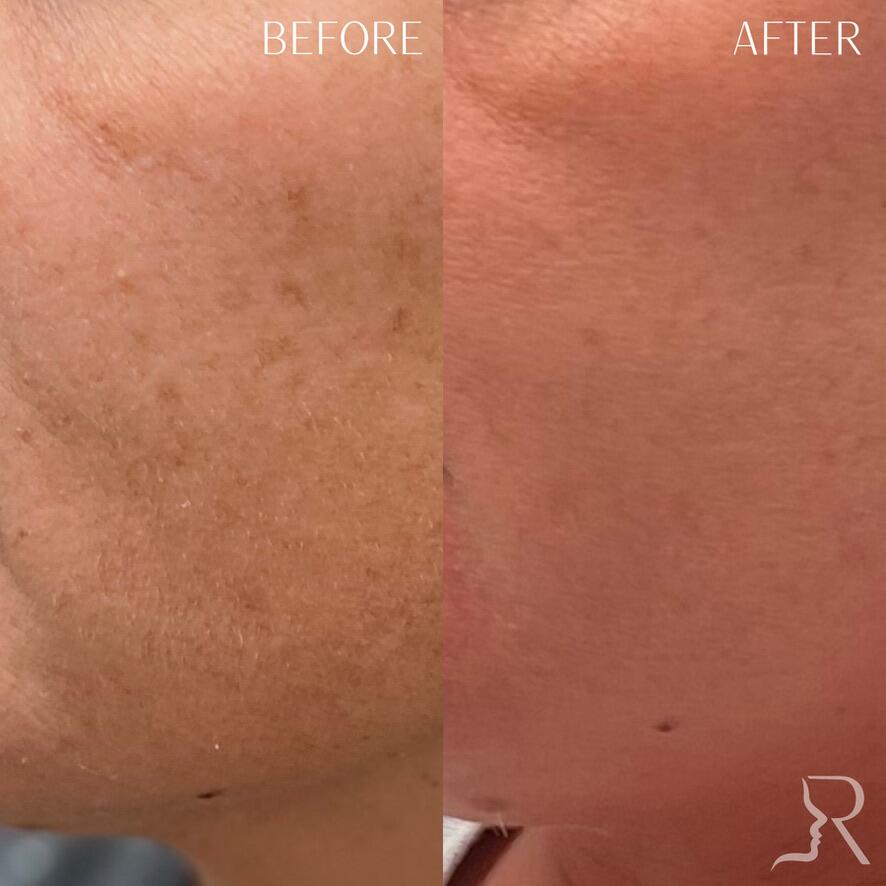 Medical-Grade Skincare Before & After Image