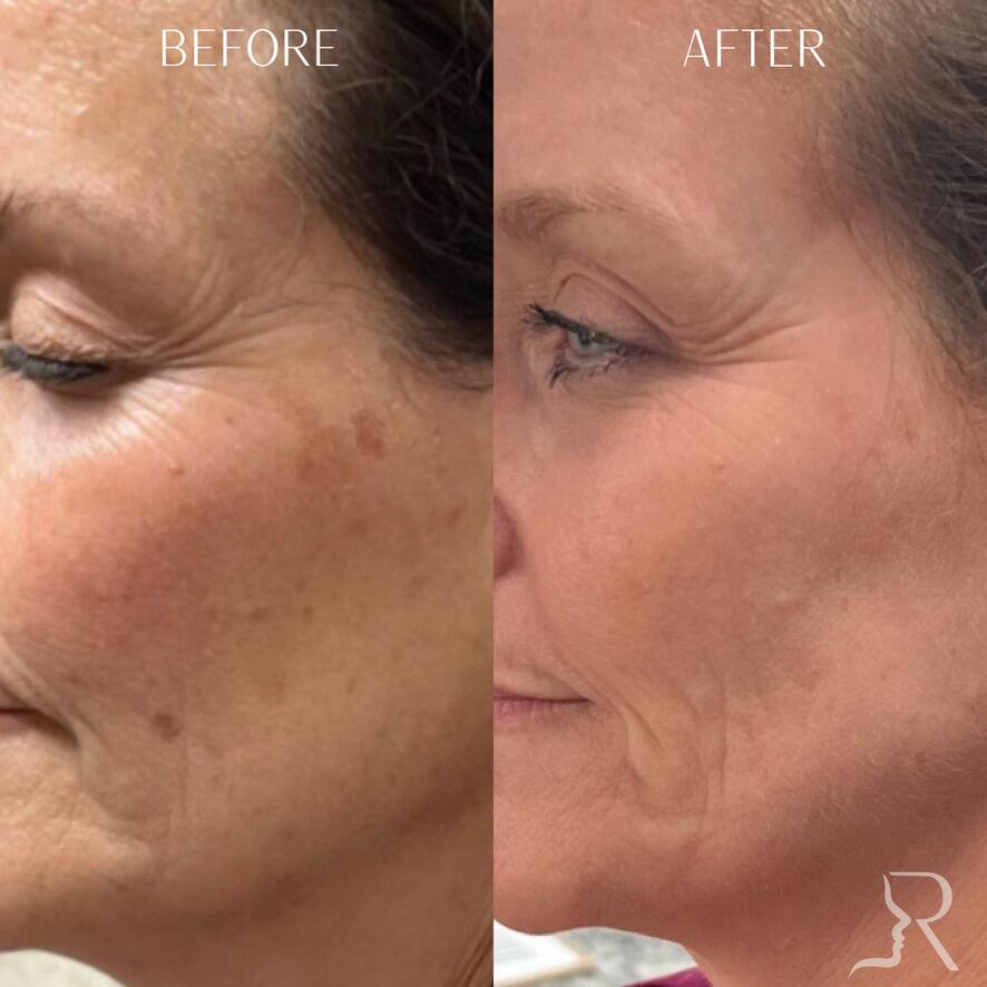 Medical-Grade Skincare Before & After Image