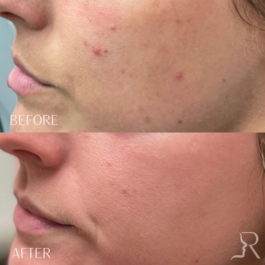 Medical-Grade Skincare Before & After Image