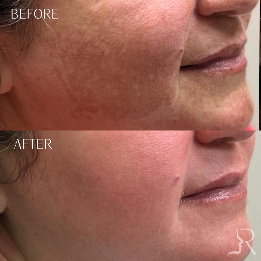 Medical-Grade Skincare Before & After Image