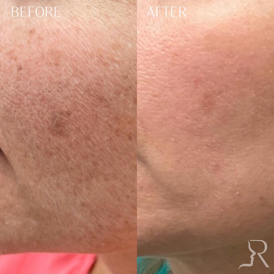 Medical-Grade Skincare Before & After Image