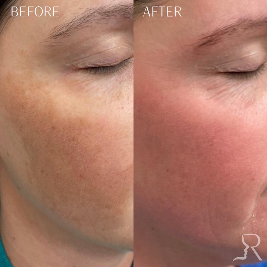 Medical-Grade Skincare Before & After Image