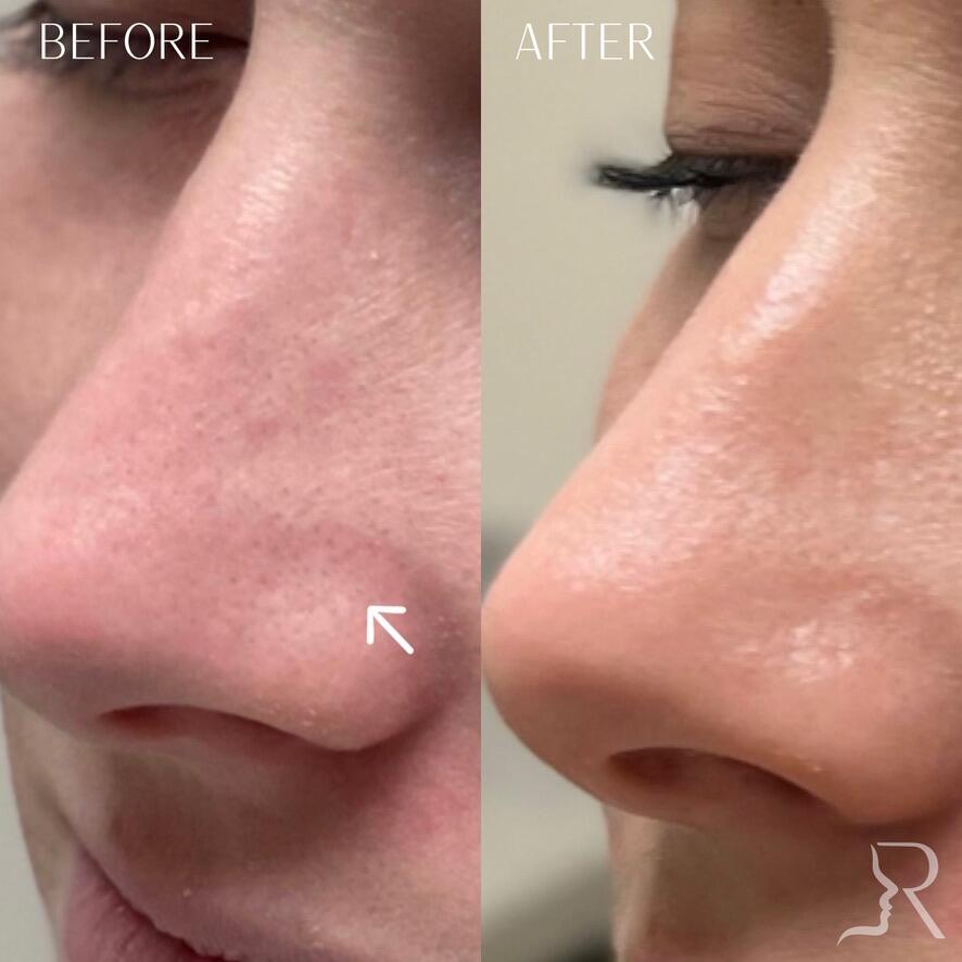 Medical-Grade Skincare Before & After Image