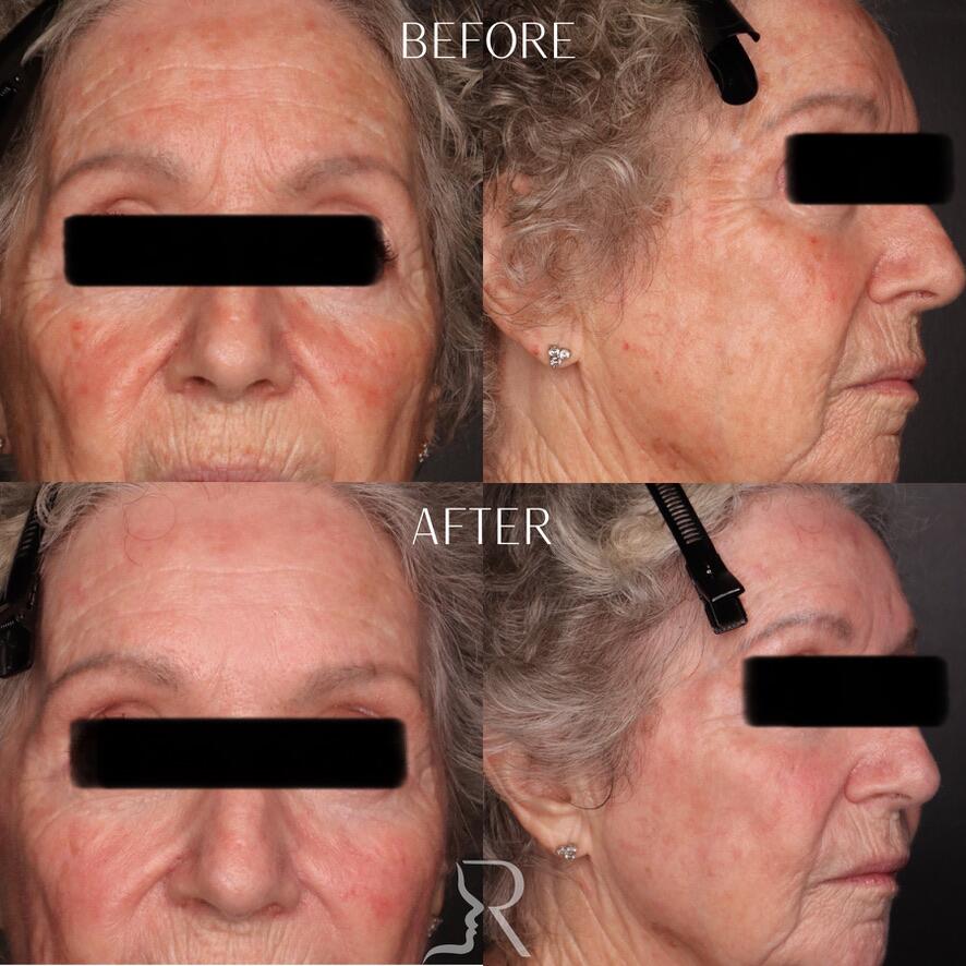 Medical-Grade Skincare Before & After Image