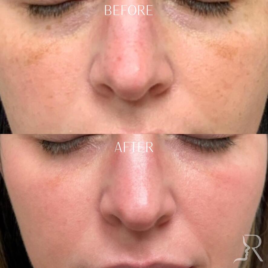 Medical-Grade Skincare Before & After Image