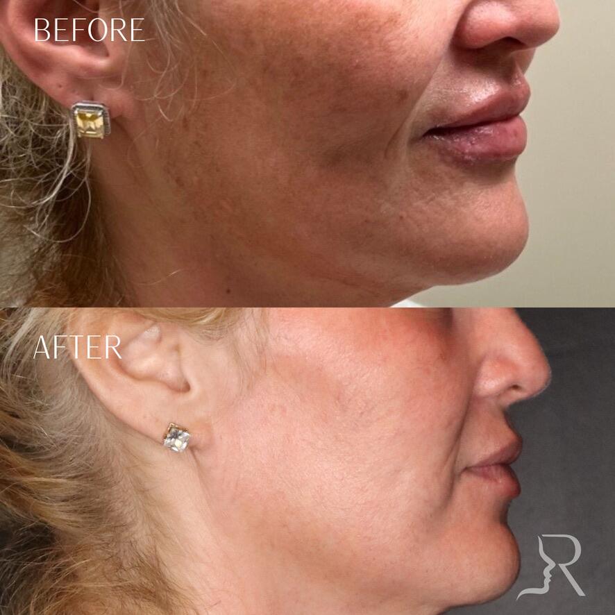 Medical-Grade Skincare Before & After Image