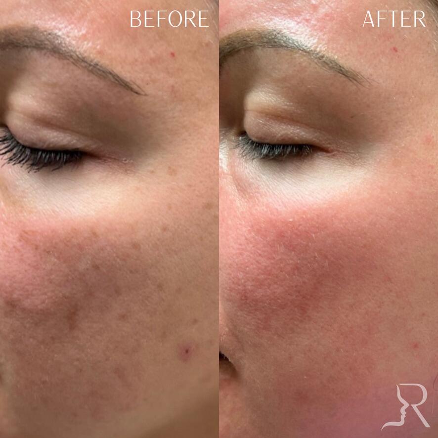 Medical-Grade Skincare Before & After Image