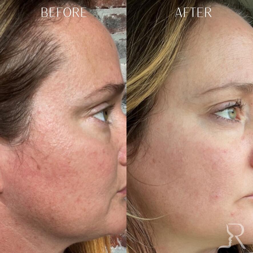 Medical-Grade Skincare Before & After Image