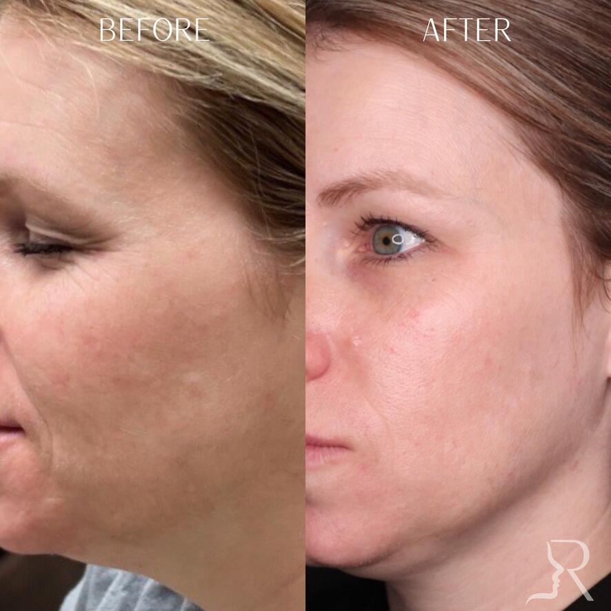 Medical-Grade Skincare Before & After Image