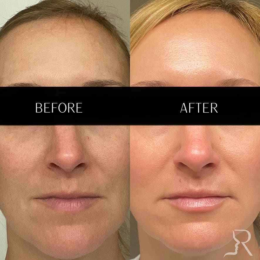 Medical-Grade Skincare Before & After Image