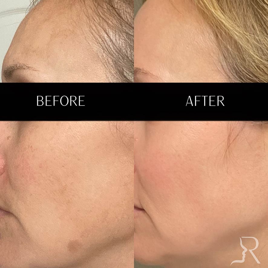 Medical-Grade Skincare Before & After Image