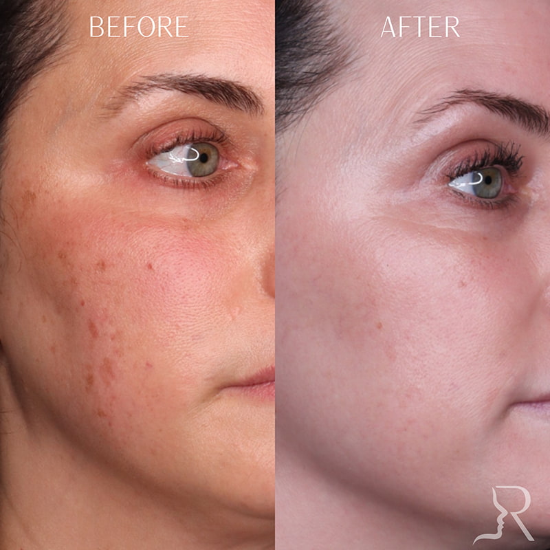 Medical-Grade Skincare Before & After Image