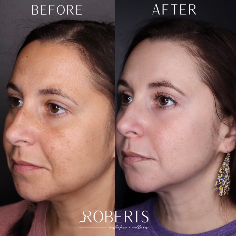 Medical-Grade Skincare Before & After Image