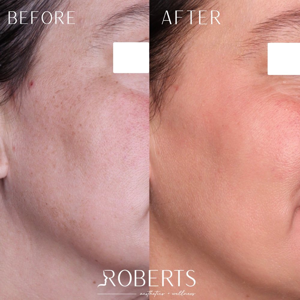 Medical-Grade Skincare Before & After Image