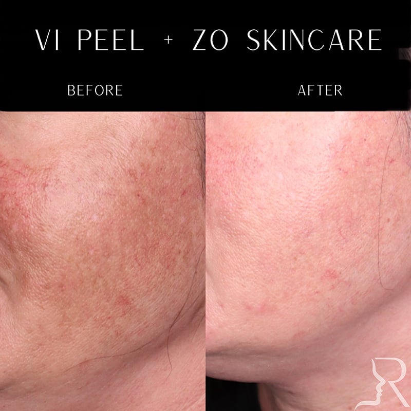 Medical-Grade Skincare Before & After Image