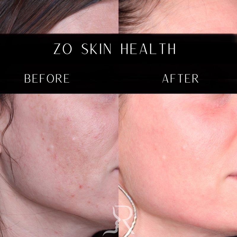 Medical-Grade Skincare Before & After Image