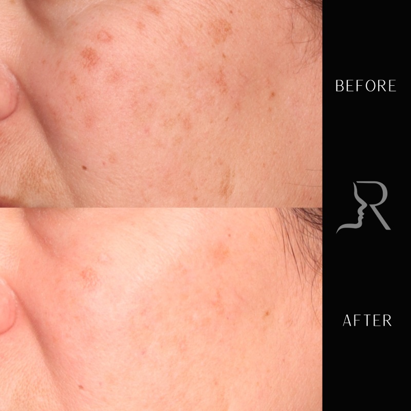 Medical-Grade Skincare Before & After Image