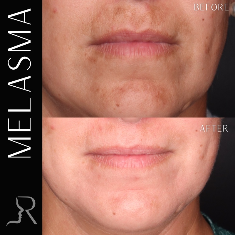 Medical-Grade Skincare Before & After Image