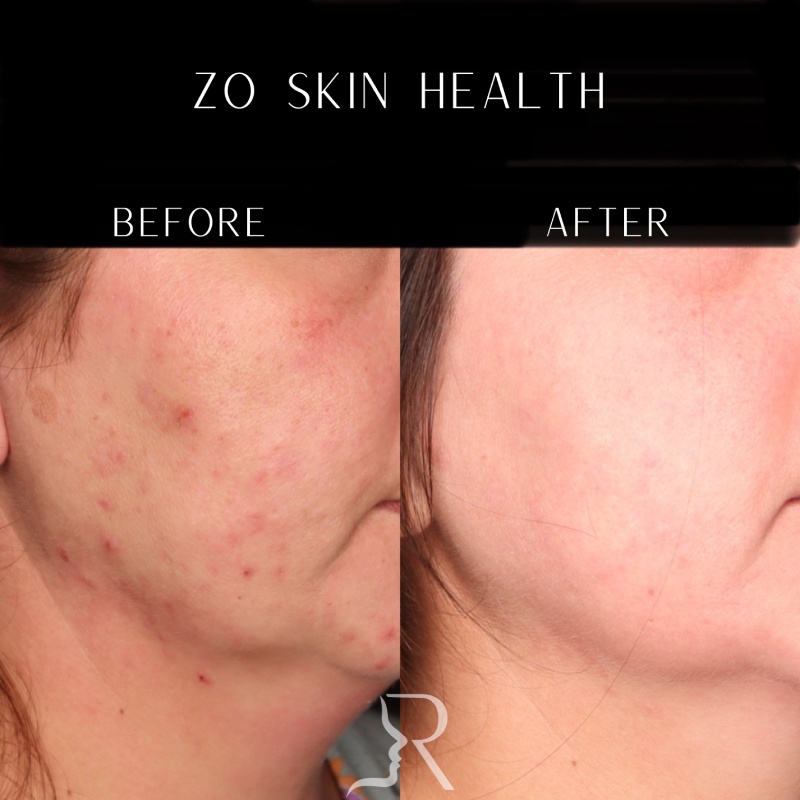 Medical-Grade Skincare Before & After Image