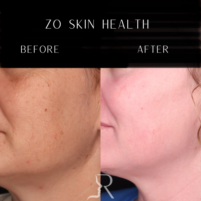 Medical-Grade Skincare Before & After Image