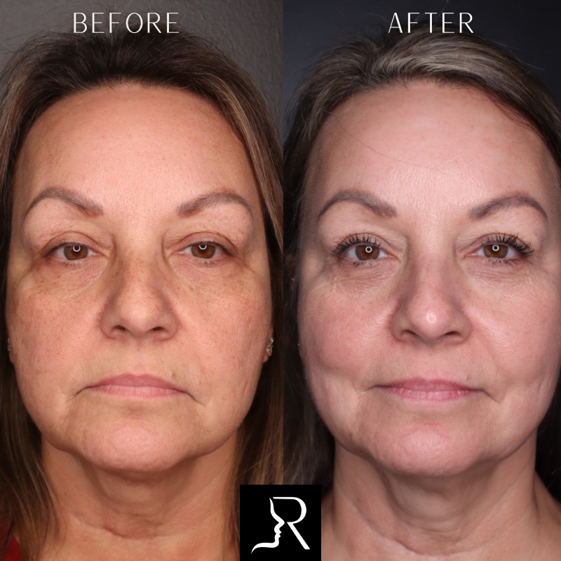 Medical-Grade Skincare Before & After Image