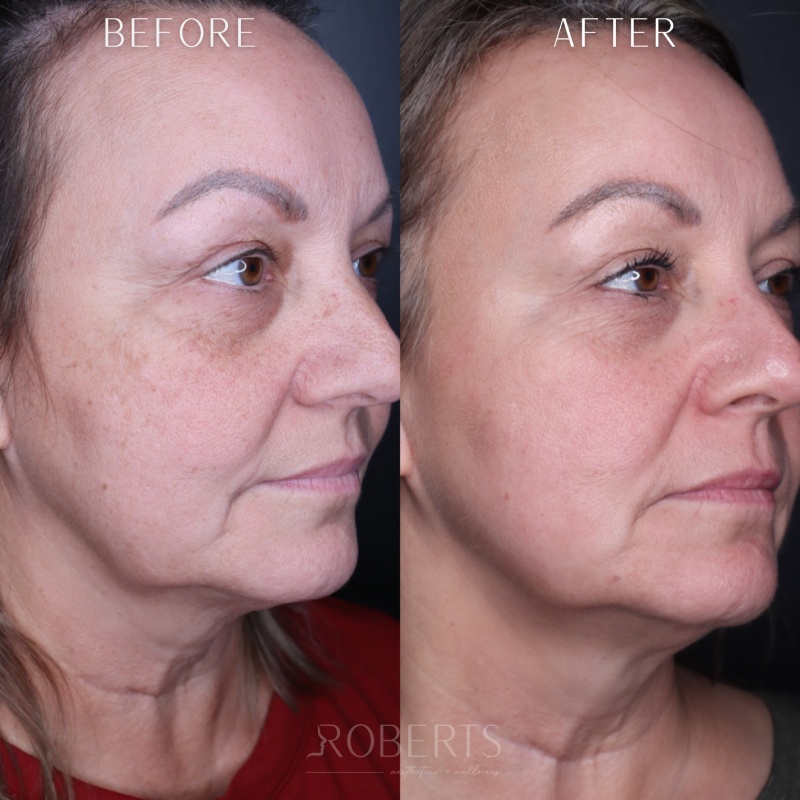 Medical-Grade Skincare Before & After Image