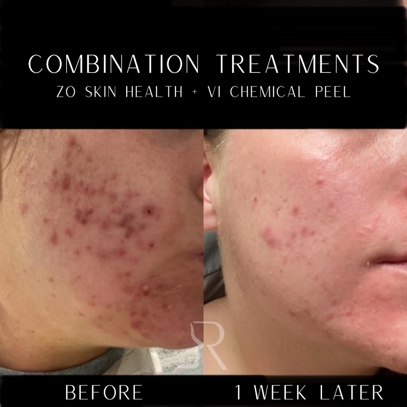 Medical-Grade Skincare Before & After Image