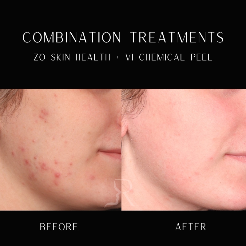 Medical-Grade Skincare Before & After Image