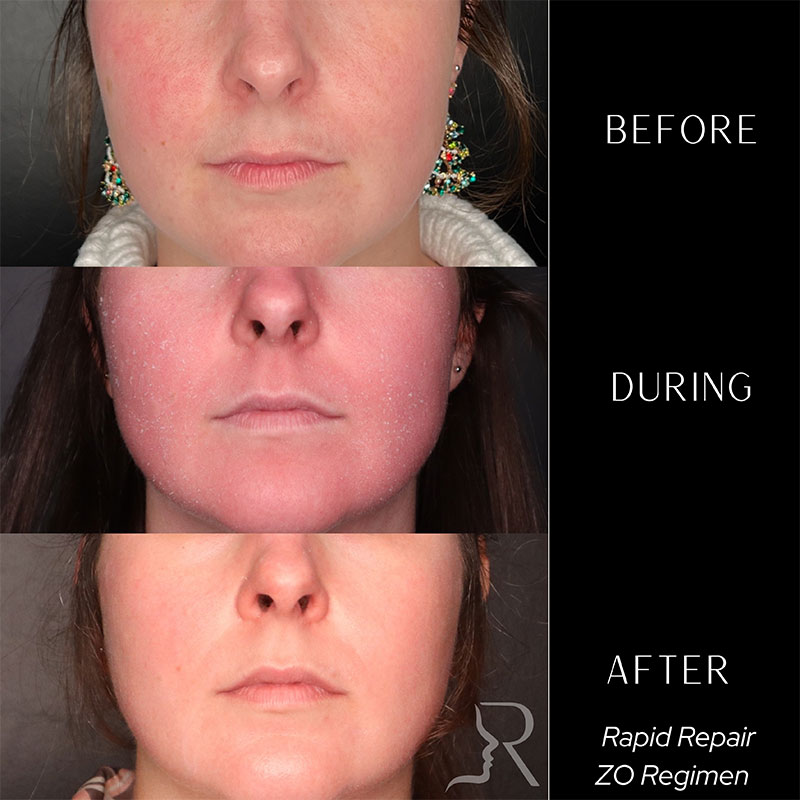 Medical-Grade Skincare Before & After Image