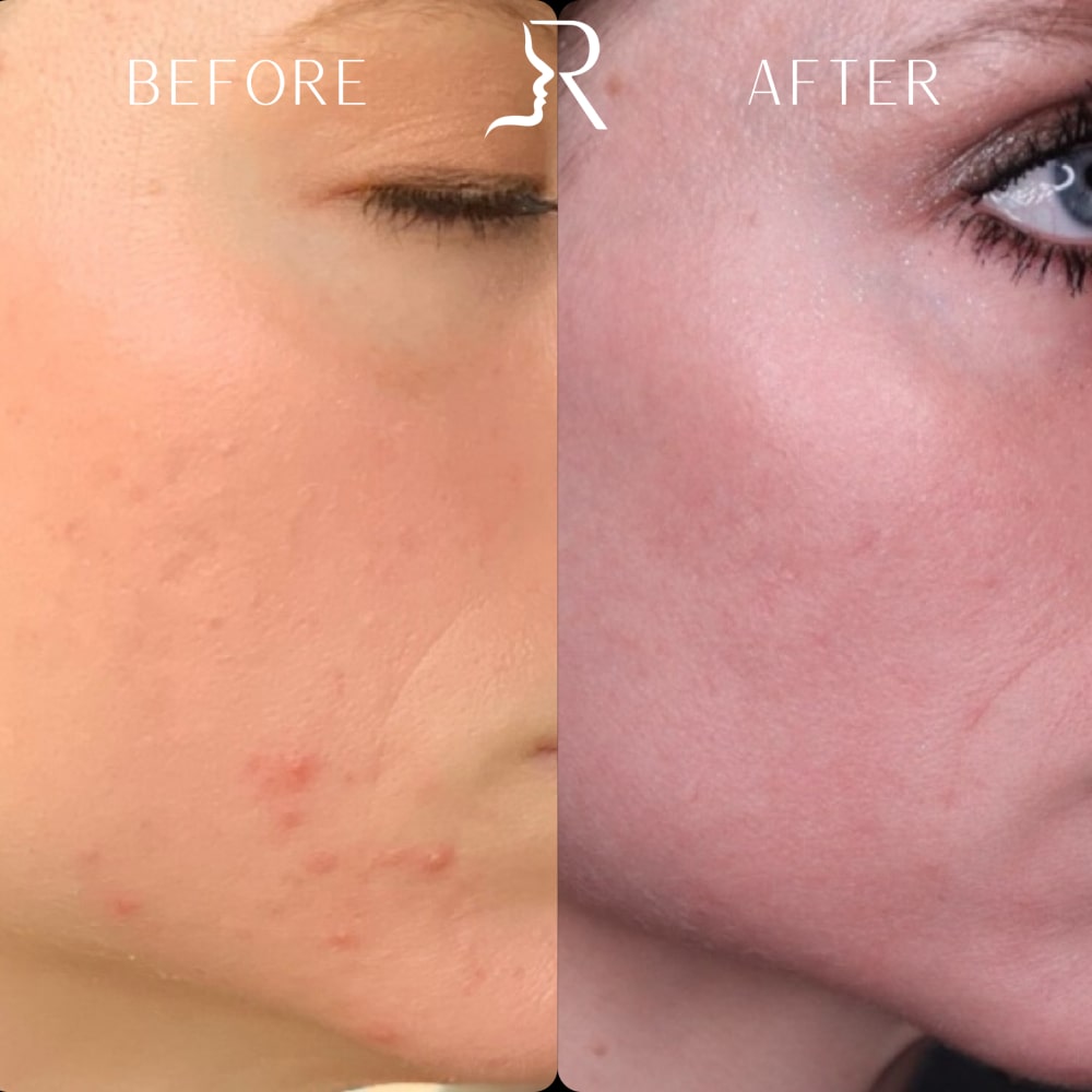 Medical-Grade Skincare Before & After Image