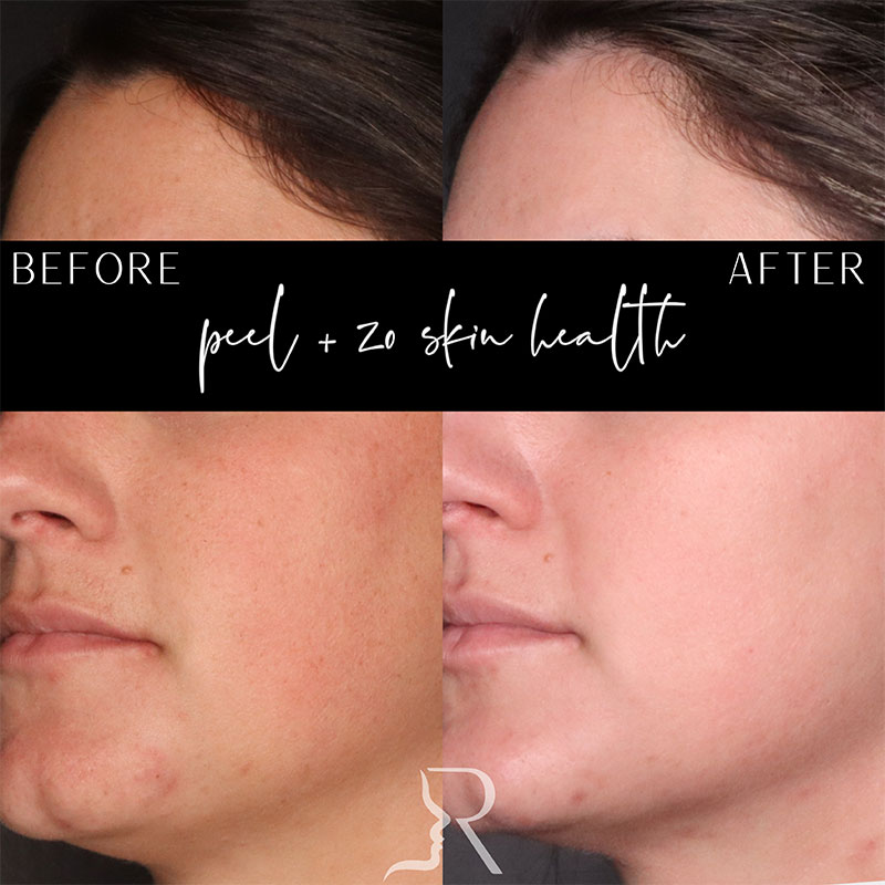 Medical-Grade Skincare Before & After Image