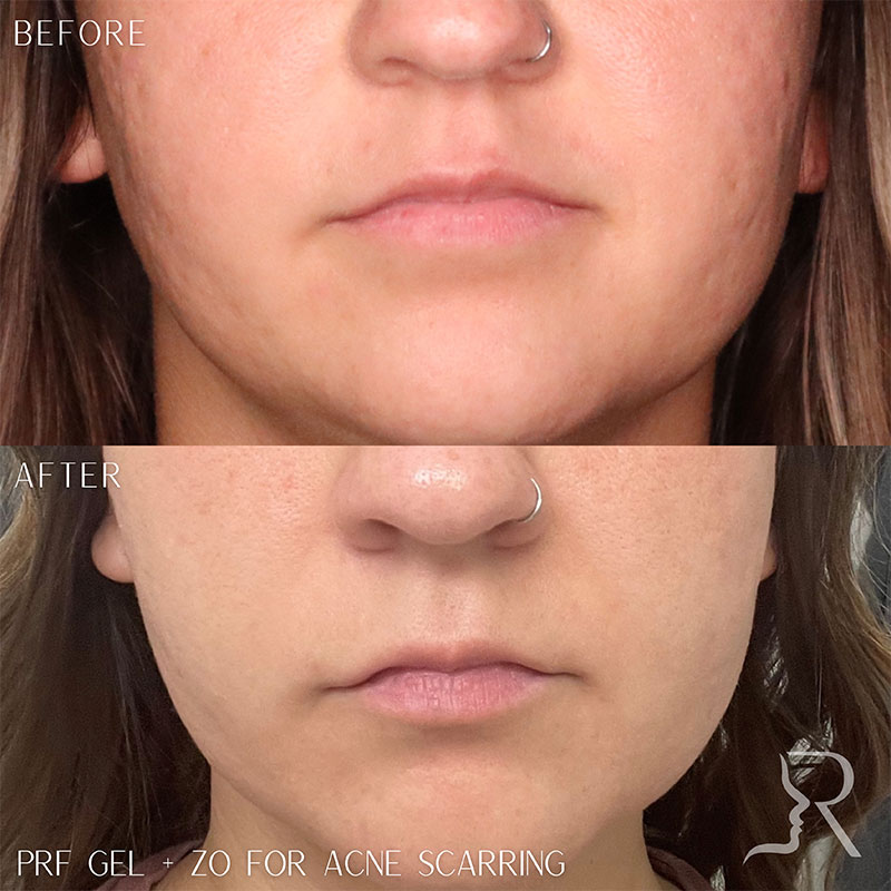 Medical-Grade Skincare Before & After Image