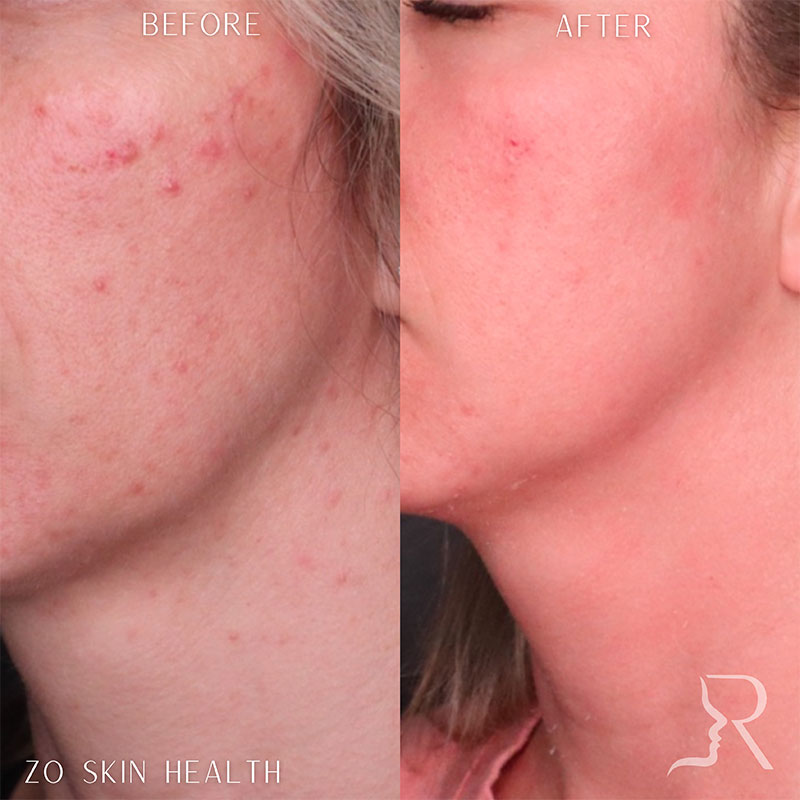 Medical-Grade Skincare Before & After Image