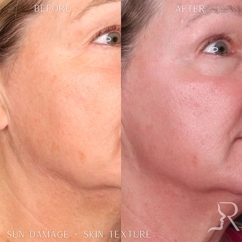 Medical-Grade Skincare Before & After Image