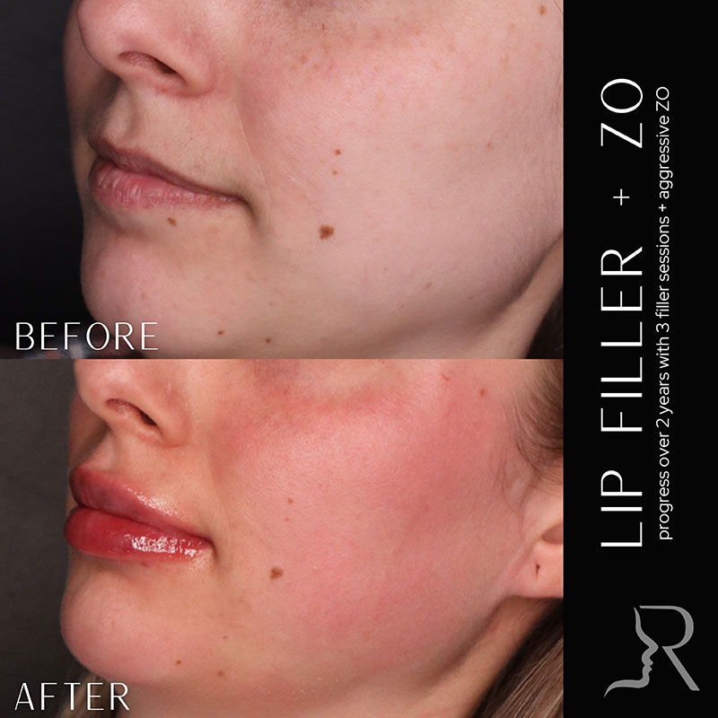 Medical-Grade Skincare Before & After Image