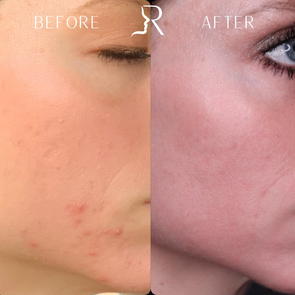 Medical Skincare Before & After Image