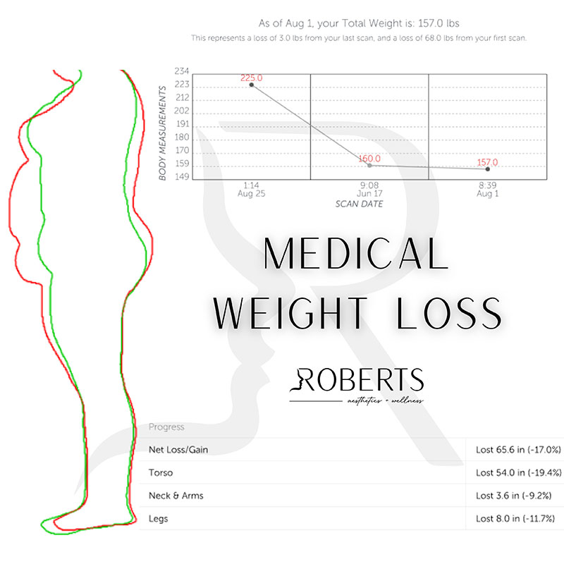 Medical Weight Loss Before & After Image